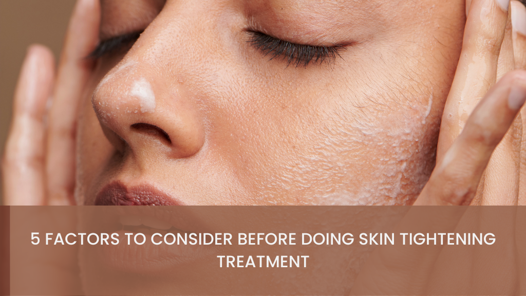 5 Factors to Consider Before Doing Skin Tightening Treatment